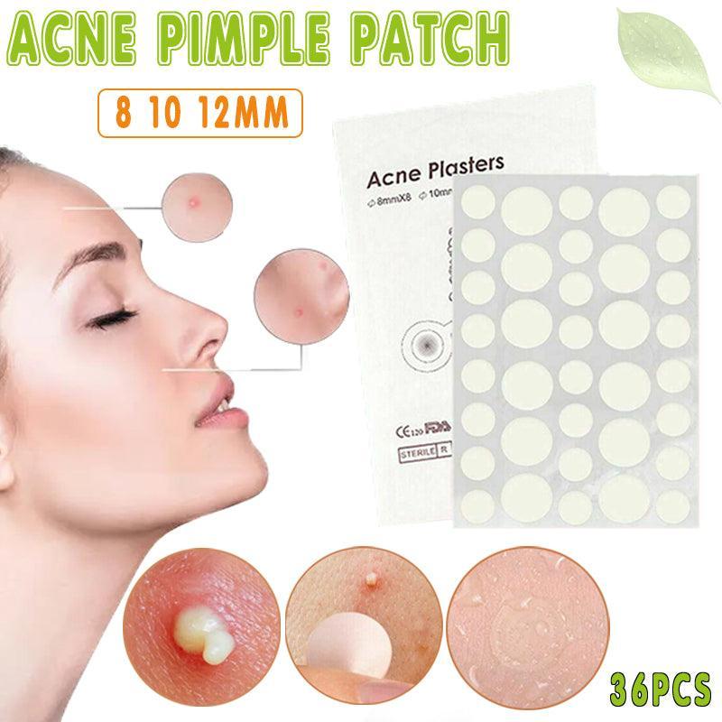 V528-36PCSACNEPLASTERS-35653-202509251016-00 36 Pcs Acne Pimple Plasters Patch Removal Blemish Control Skin Facial Care Spot - Image 1